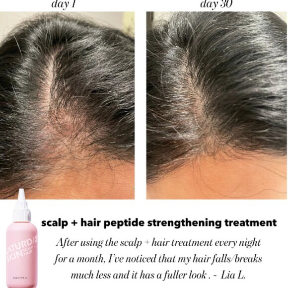 NIB saturday skin scalp treatment - Picture 2 of 2